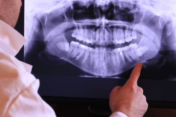 Best Emergency Tooth Extraction in York, PA